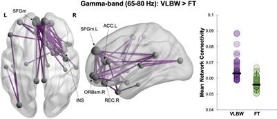 Social-Cognitive Network Connectivity in Preterm Children and Relations With Early Nutrition and Developmental Outcomes